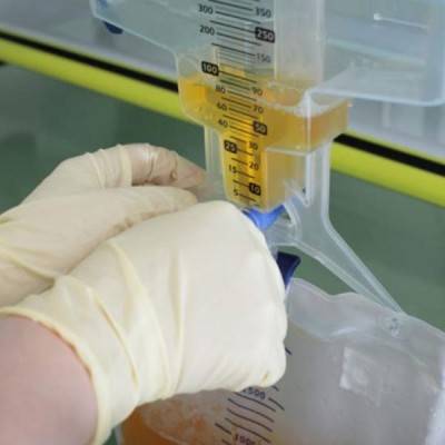 Best Urine Catheter Insertion At Home in Begusarai